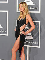 Anne Vyalitsyna exposed her long sexy legs